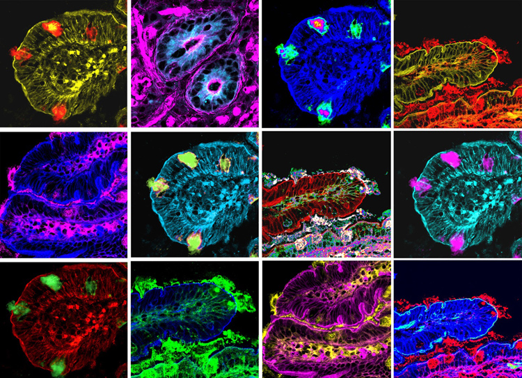 microbiota-villi-intestinali